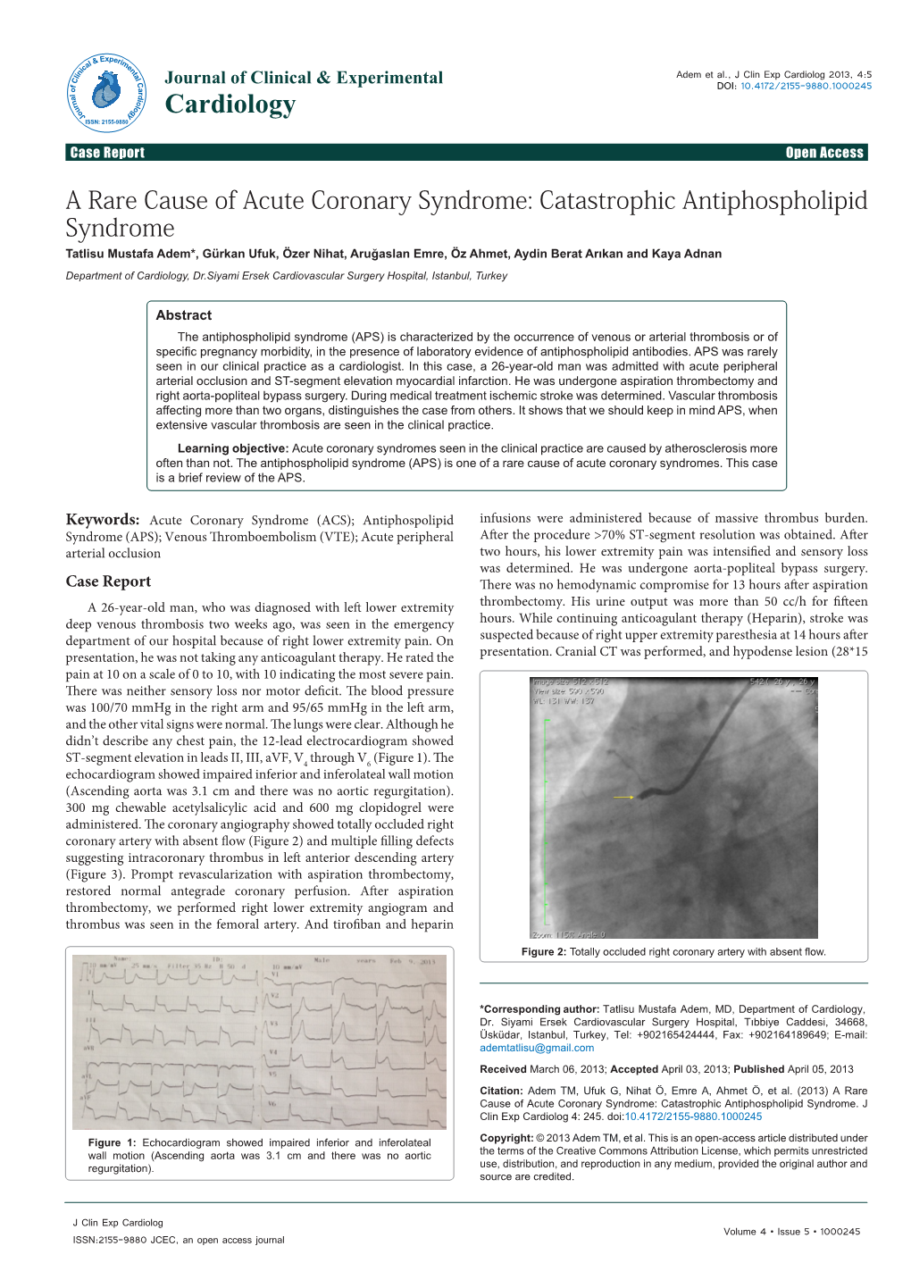 A Rare Cause of Acute Coronary Syndrome