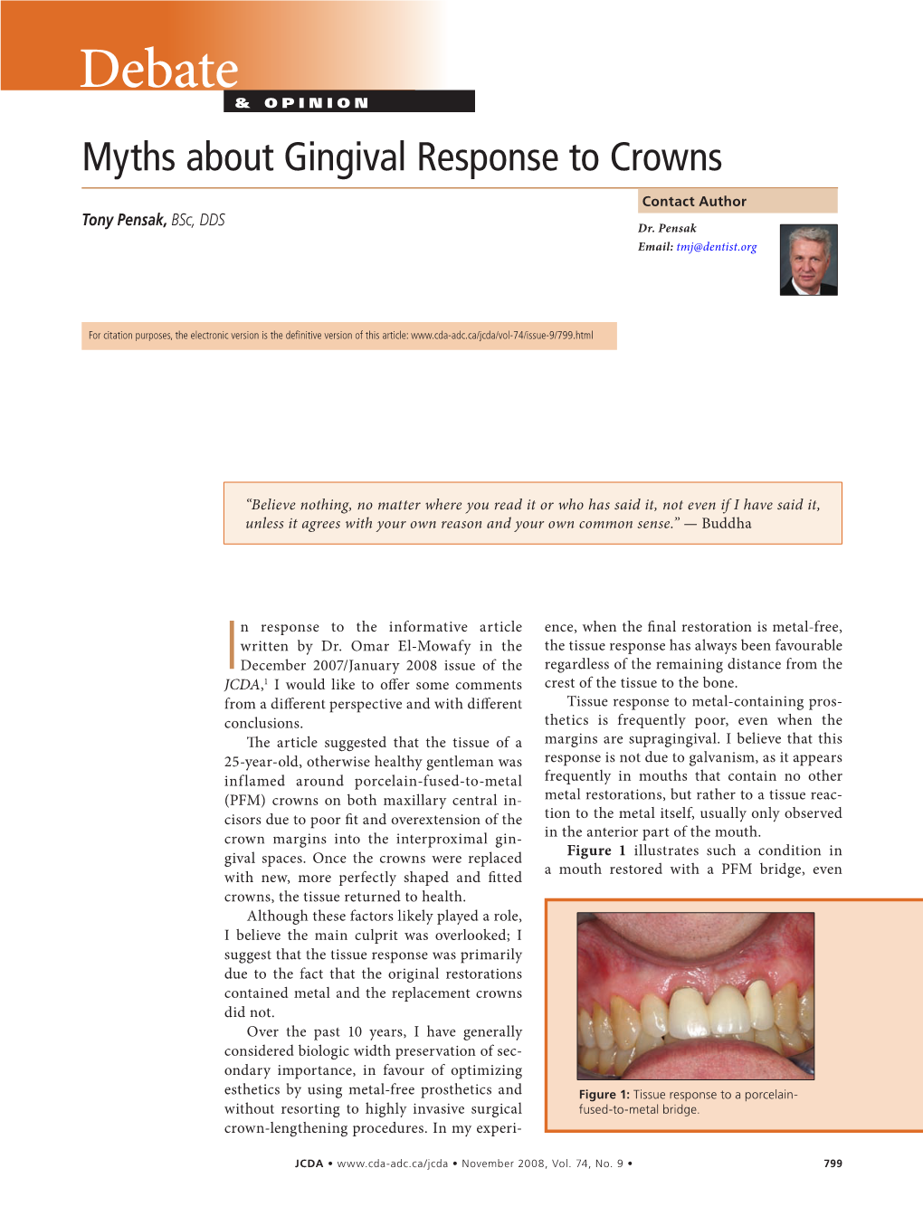 Myths About Gingival Response to Crowns