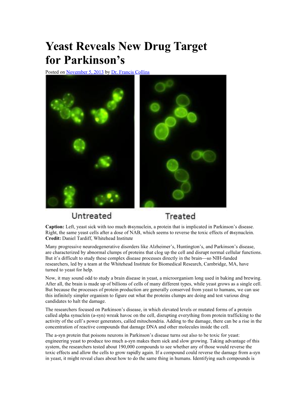 Yeast Reveals New Drug Target Forparkinson S