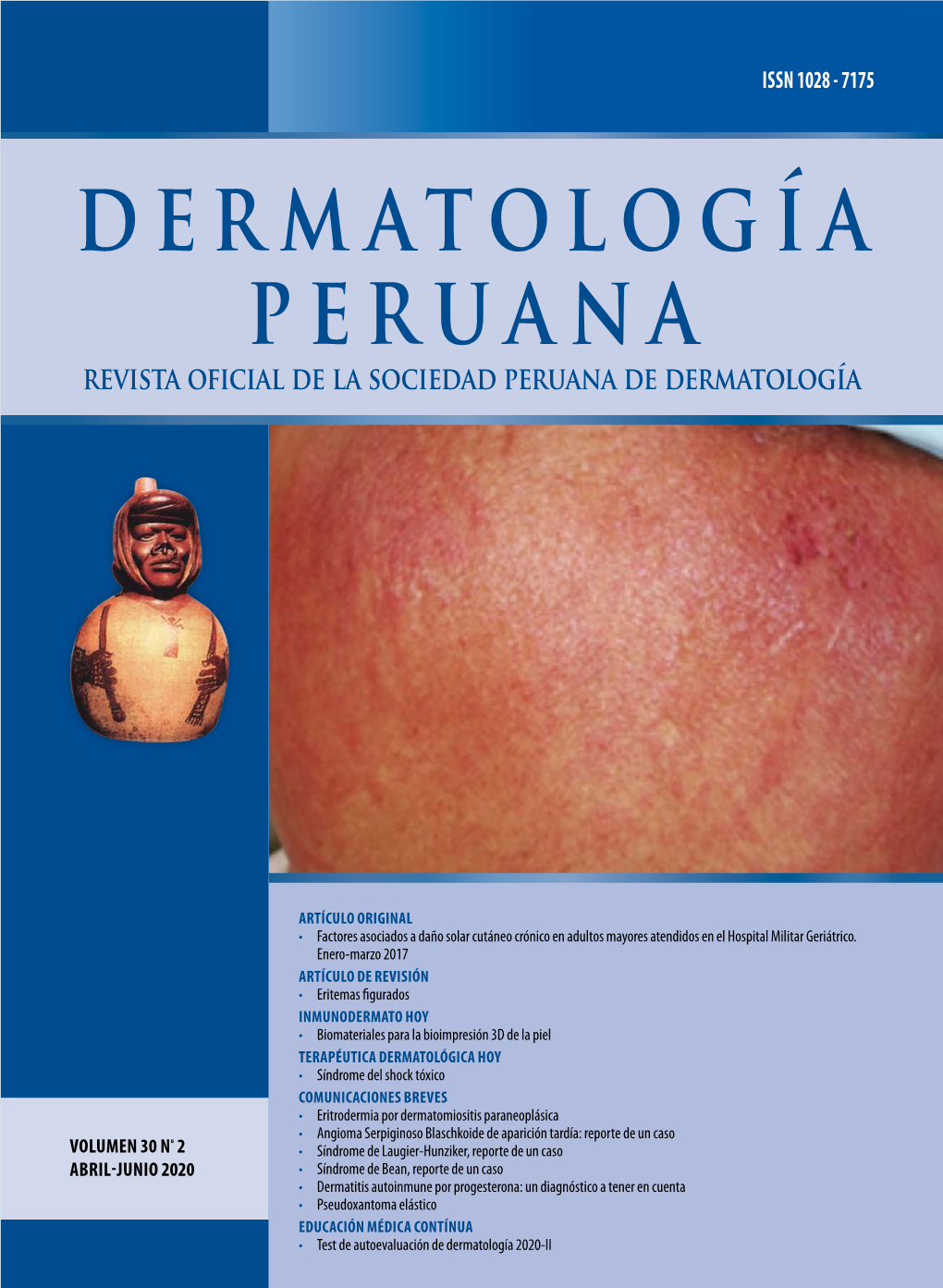 Eritrodermia Por Dermatomiositis Paraneoplásica