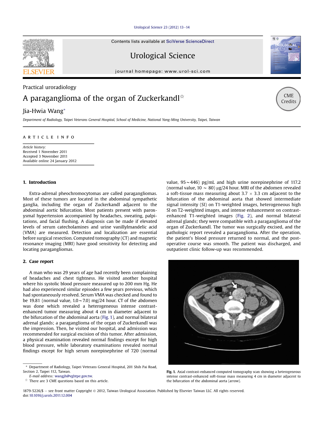 A Paraganglioma of the Organ of Zuckerkandl Credits Jia-Hwia Wang*