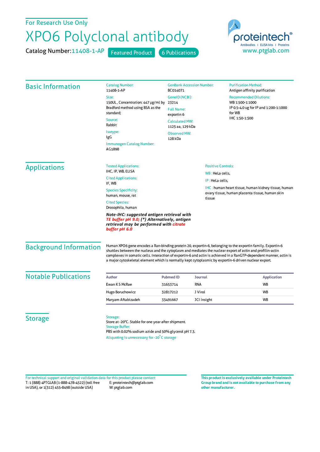 XPO6 Polyclonal Antibody Catalog Number:11408-1-AP Featured Product 6 Publications