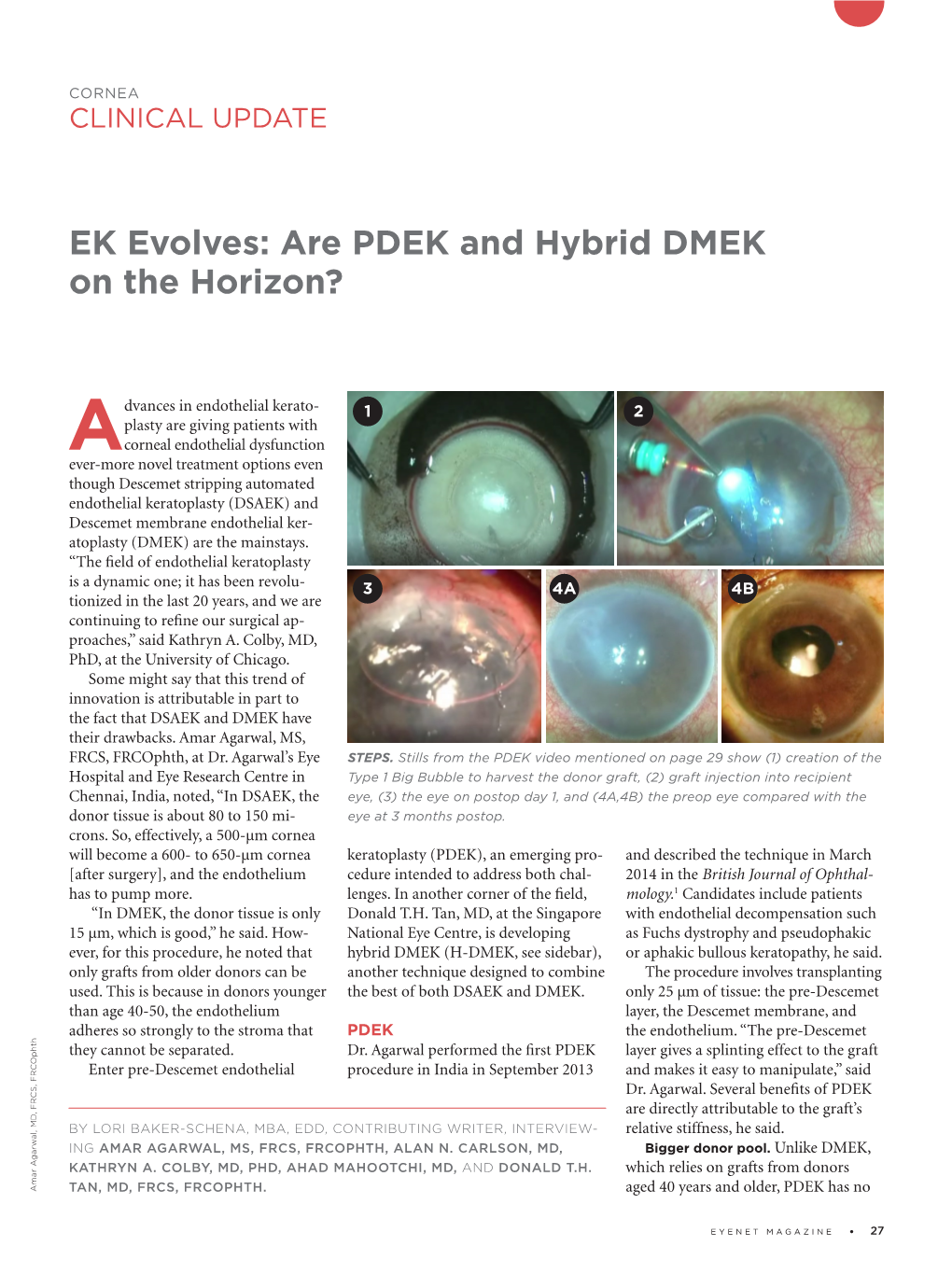 EK Evolves: Are PDEK and Hybrid DMEK on the Horizon?