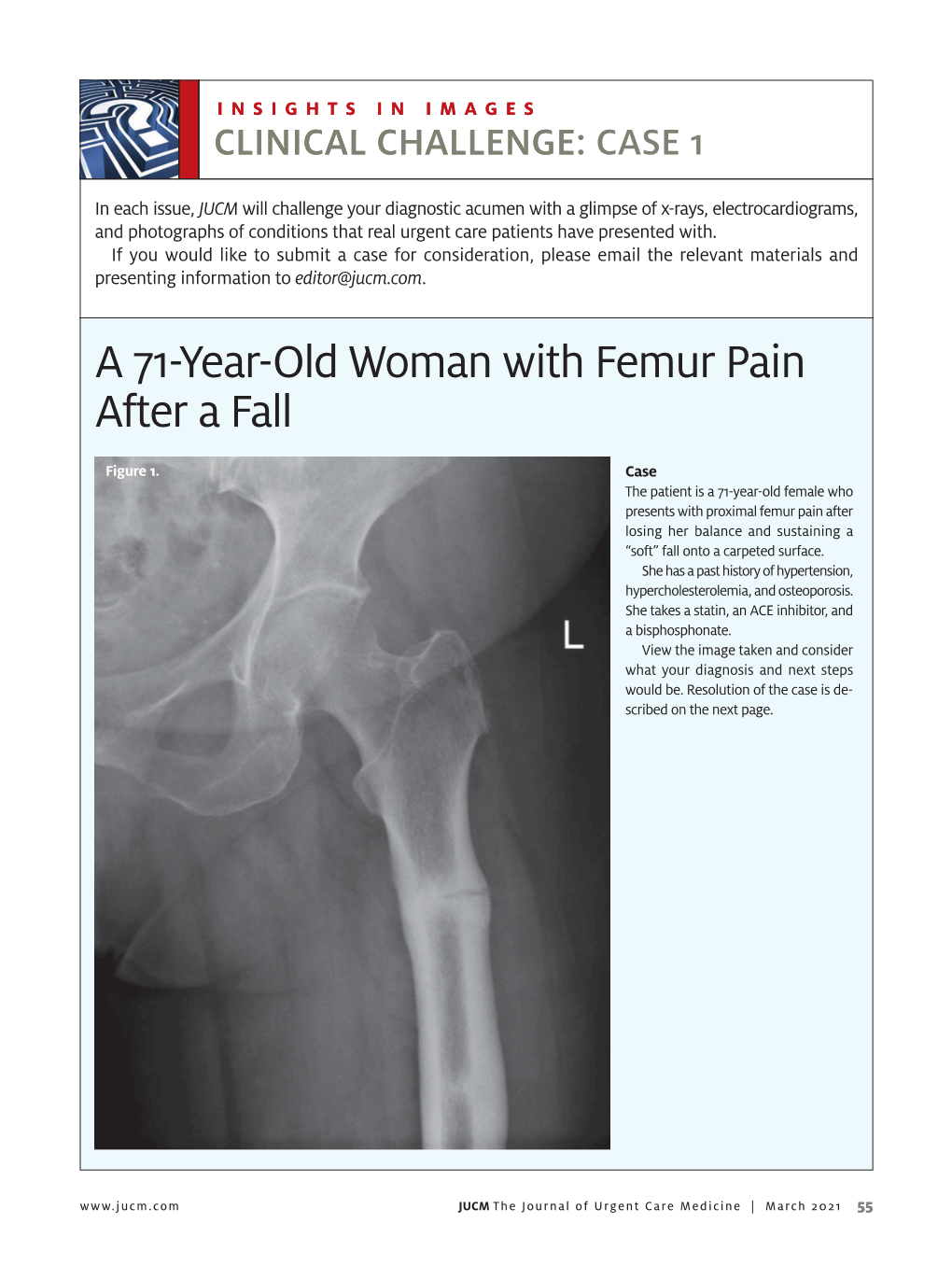 A 71-Year-Old Woman with Femur Pain After a Fall