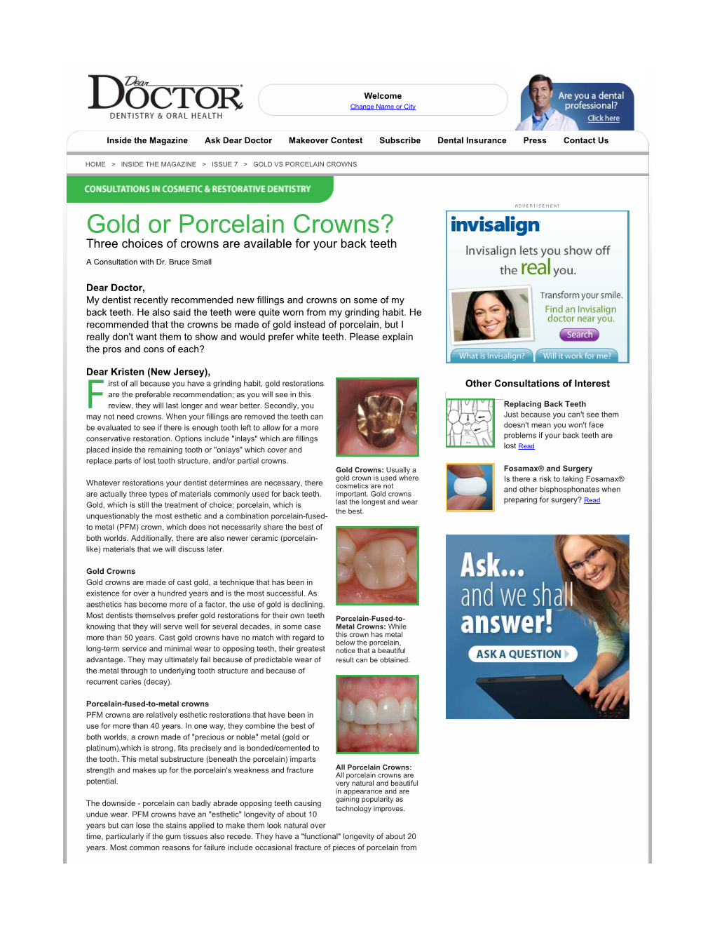 Gold Or Porcelain Crowns? Three Choices of Crowns Are Available for Your Back Teeth