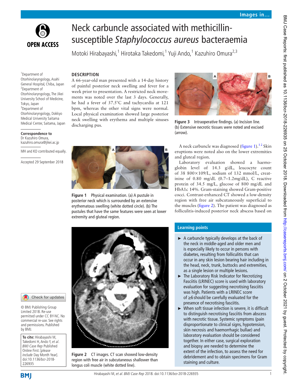 Neck Carbuncle Associated with Methicillin- Susceptible Staphylococcus Aureus Bacteraemia Motoki Hirabayashi,1 Hirotaka Takedomi,1 Yuji Ando,1 Kazuhiro Omura2,3