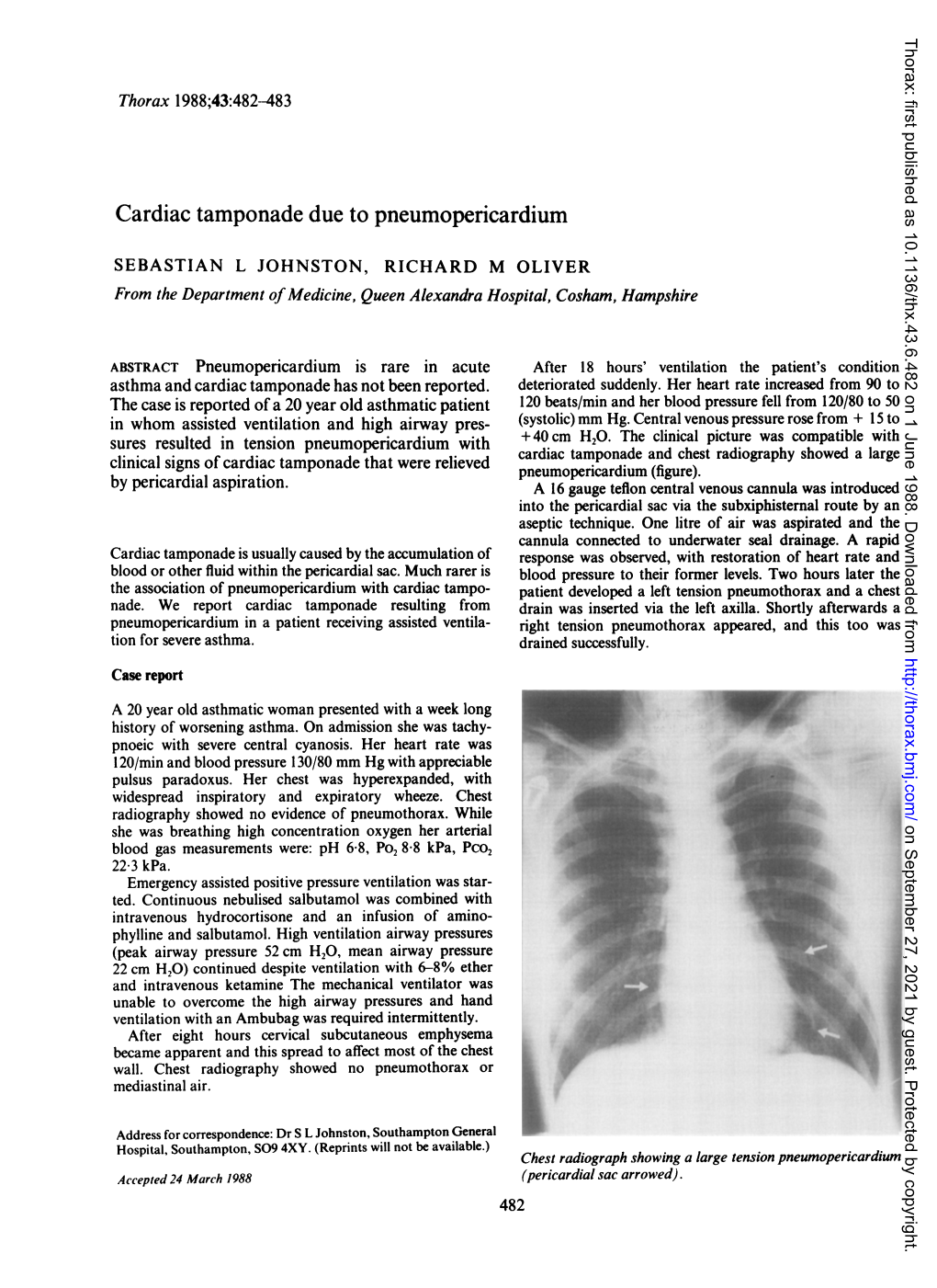 Cardiac Tamponade Due to Pneumopericardium