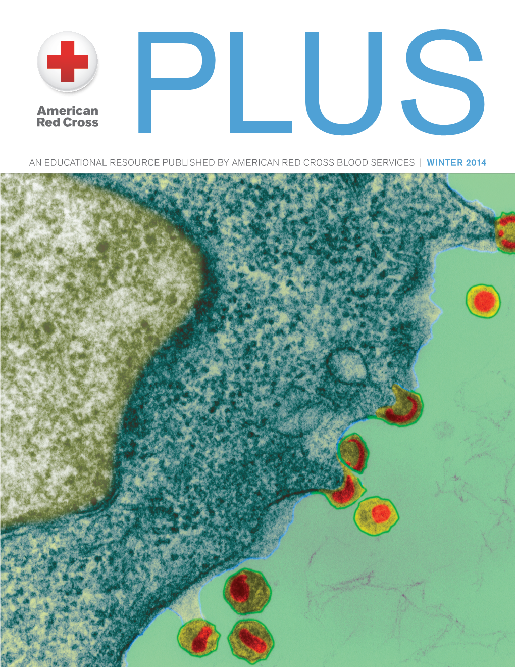 AN EDUCATIONAL RESOURCE PUBLISHED by AMERICAN RED CROSS BLOOD SERVICES | Winter 2014 Transfusion-Transmitted AIDS: a Look at the First?/Last? 30 Years