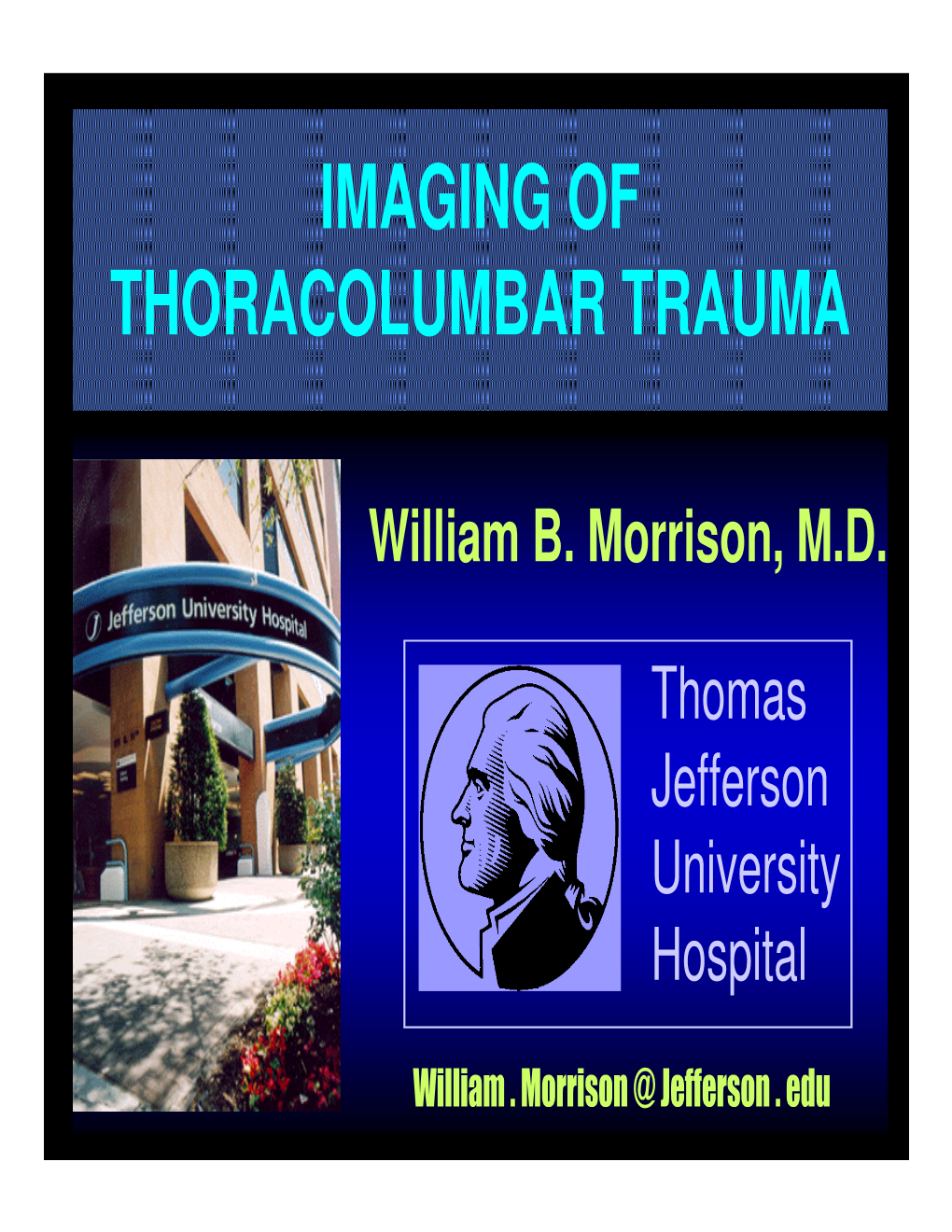 Imaging of Thoracolumbar Trauma