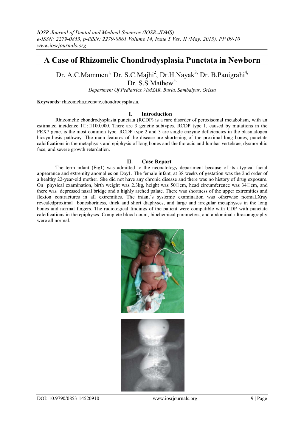 A Case of Rhizomelic Chondrodysplasia Punctata in Newborn