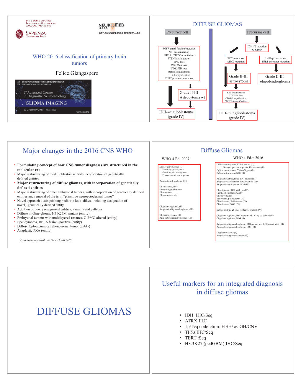 Grading Astrocytoma