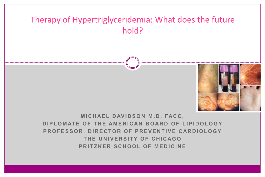 Therapy of Hypertriglyceridemia: What Does the Future Hold?