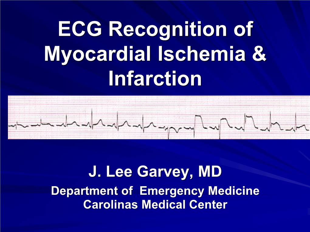 EKG Recognition of Myocardial Ischemia & Infarction