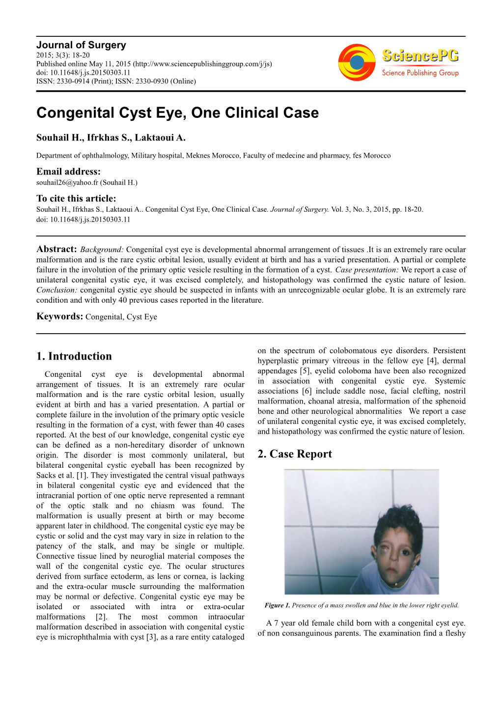 Congenital Cyst Eye, One Clinical Case