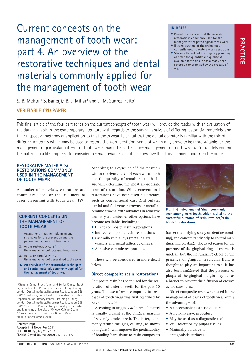 Current Concepts on the Management of Tooth Wear: Complex Restorative Care Cannot Be Cure Upon the Physical Properties of Three Compos- Part 2