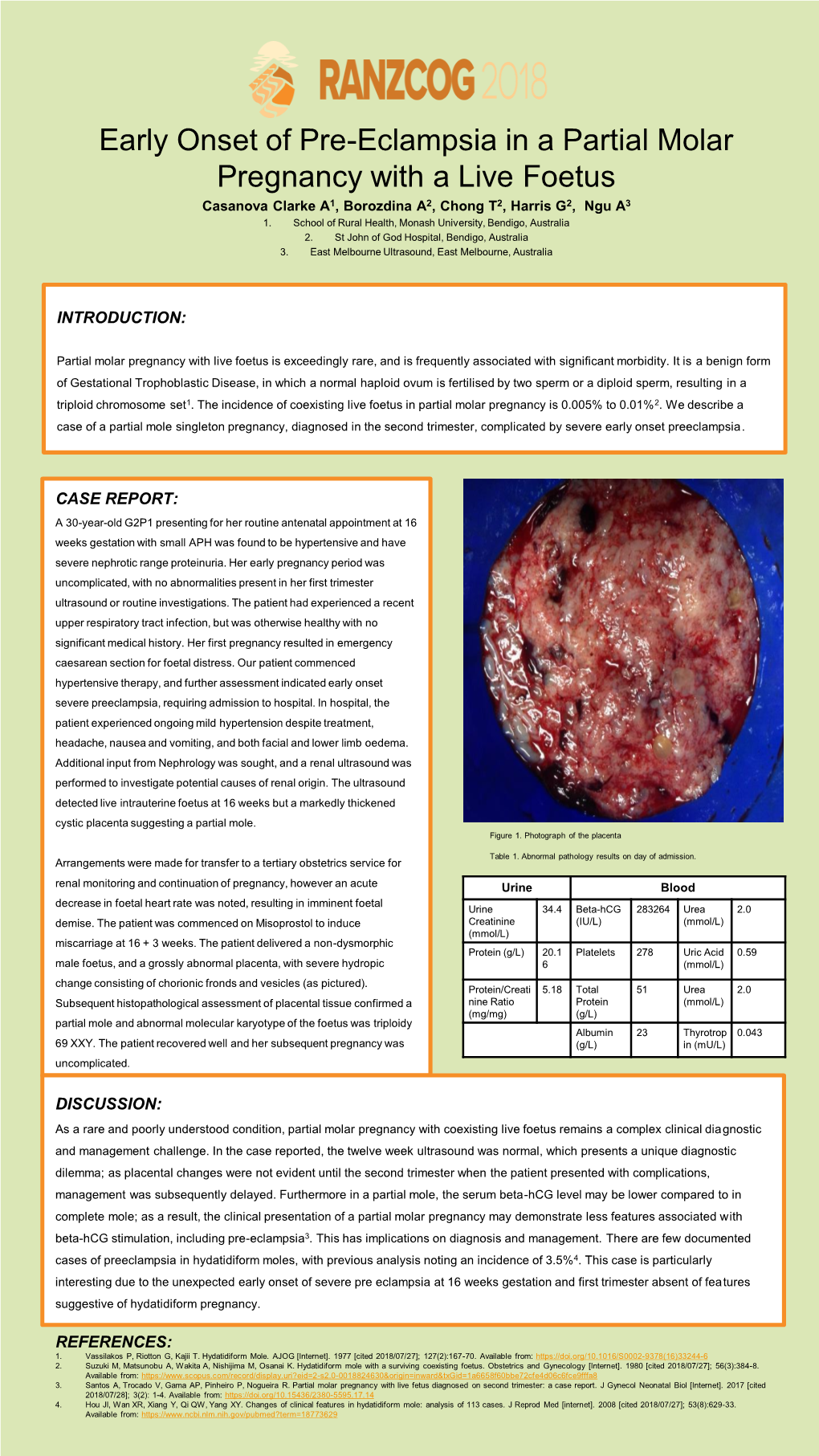 Early Onset of Pre-Eclampsia in a Partial Molar Pregnancy with a Live Foetus Casanova Clarke A1, Borozdina A2, Chong T2, Harris G2, Ngu A3 1