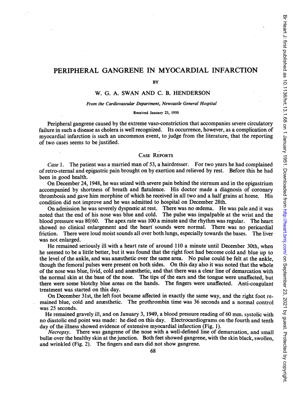 Peripheral Gangrene in Myocardial Infarction by W