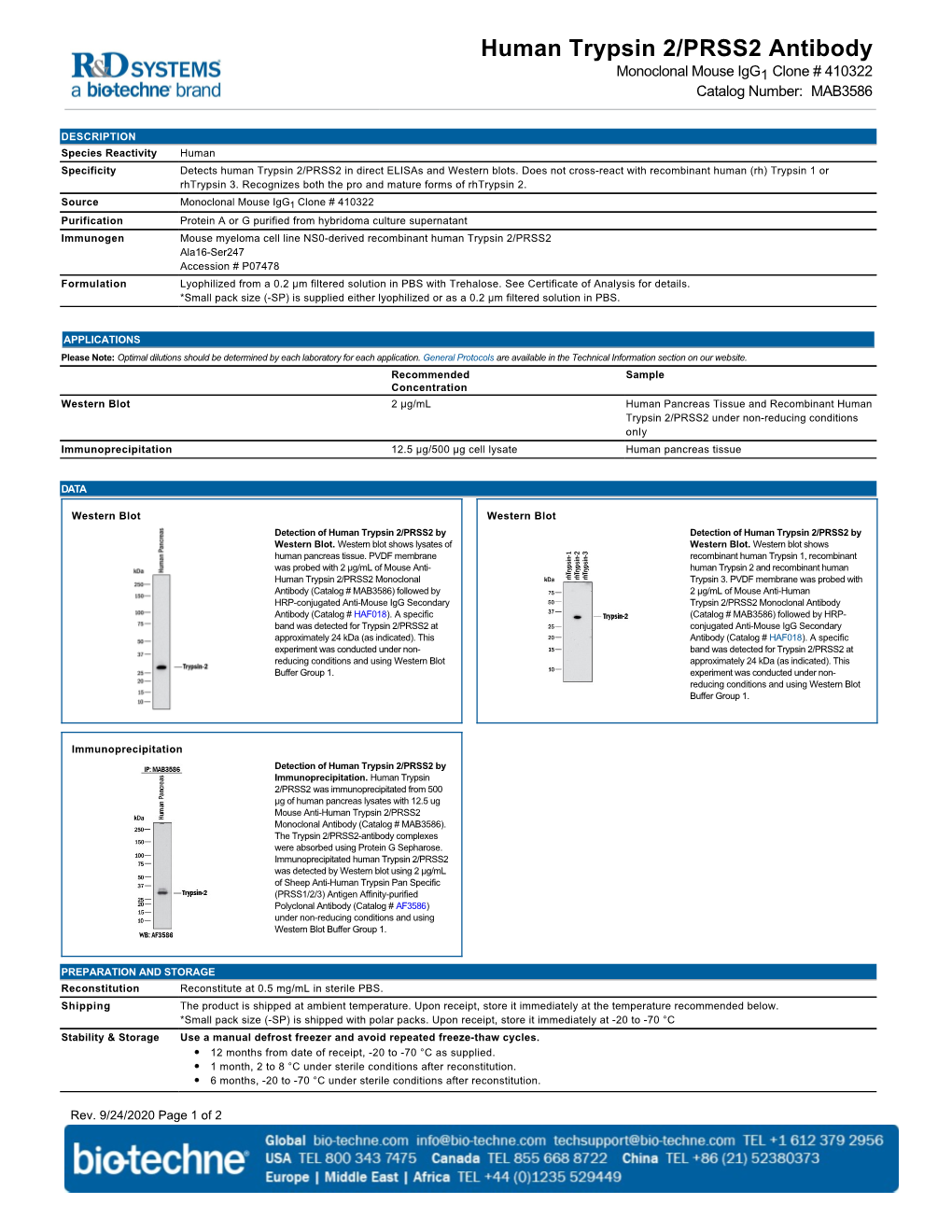 Human Trypsin 2/PRSS2 Antibody