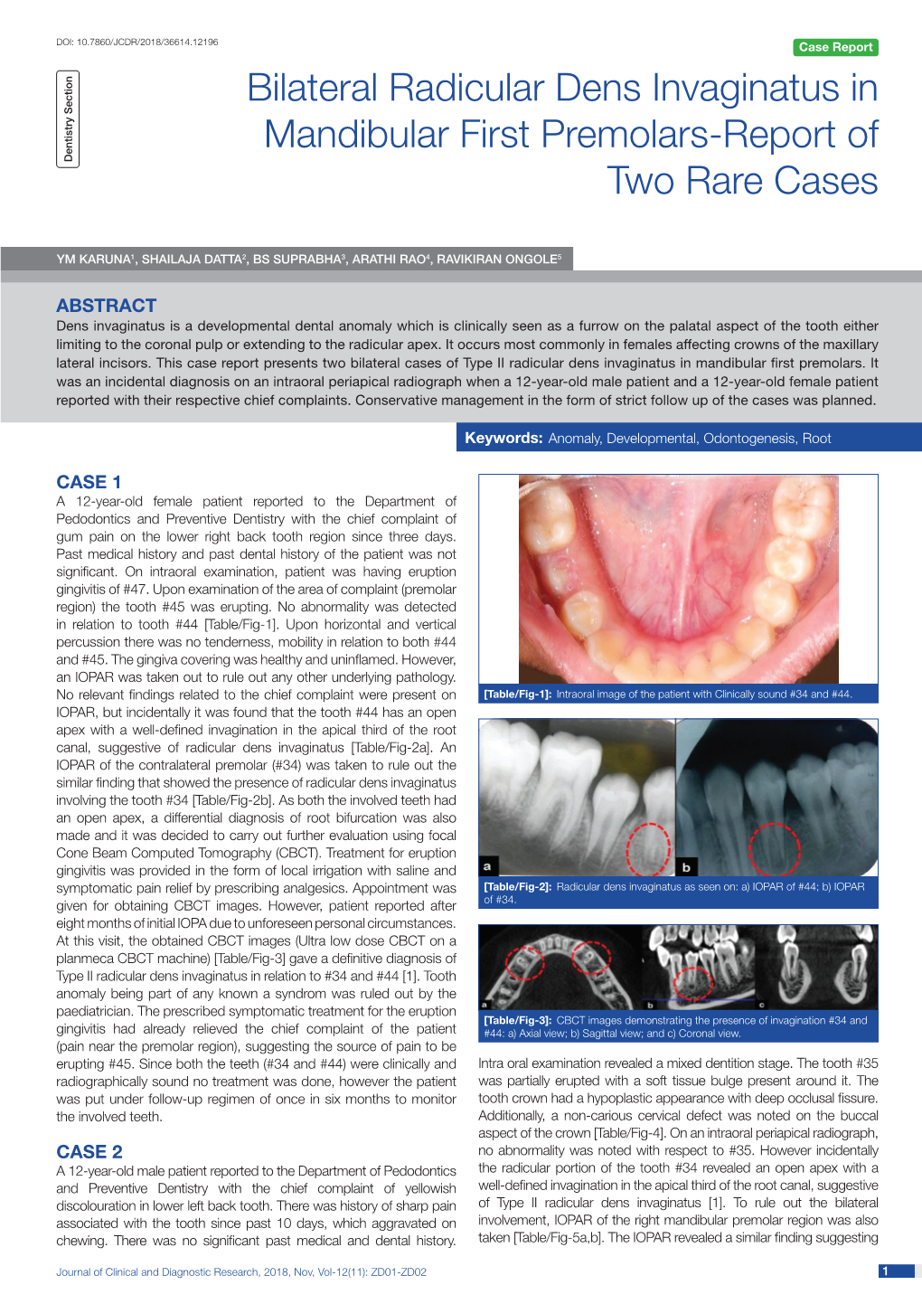 Bilateral Radicular Dens Invaginatus in Mandibular First Premolars-Report of Two Rare Cases