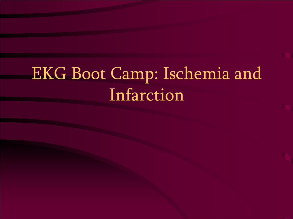 EKG Boot Camp: Ischemia and Infarction