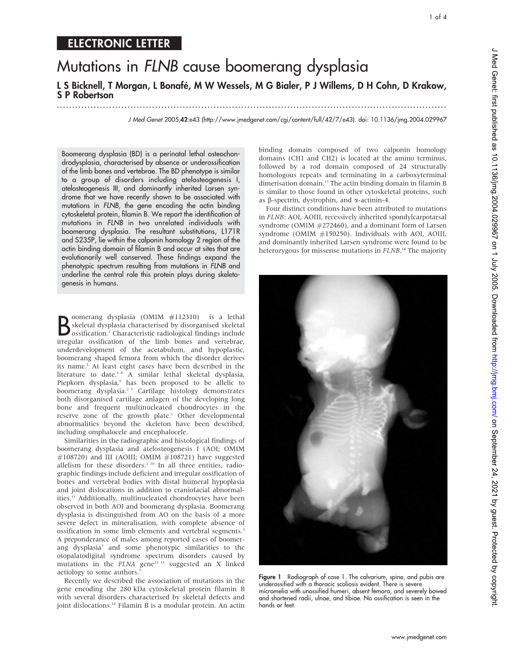 Mutations in FLNB Cause Boomerang Dysplasia L S Bicknell, T Morgan, L Bonafe´, M W Wessels, M G Bialer, P J Willems, D H Cohn, D Krakow, S P Robertson