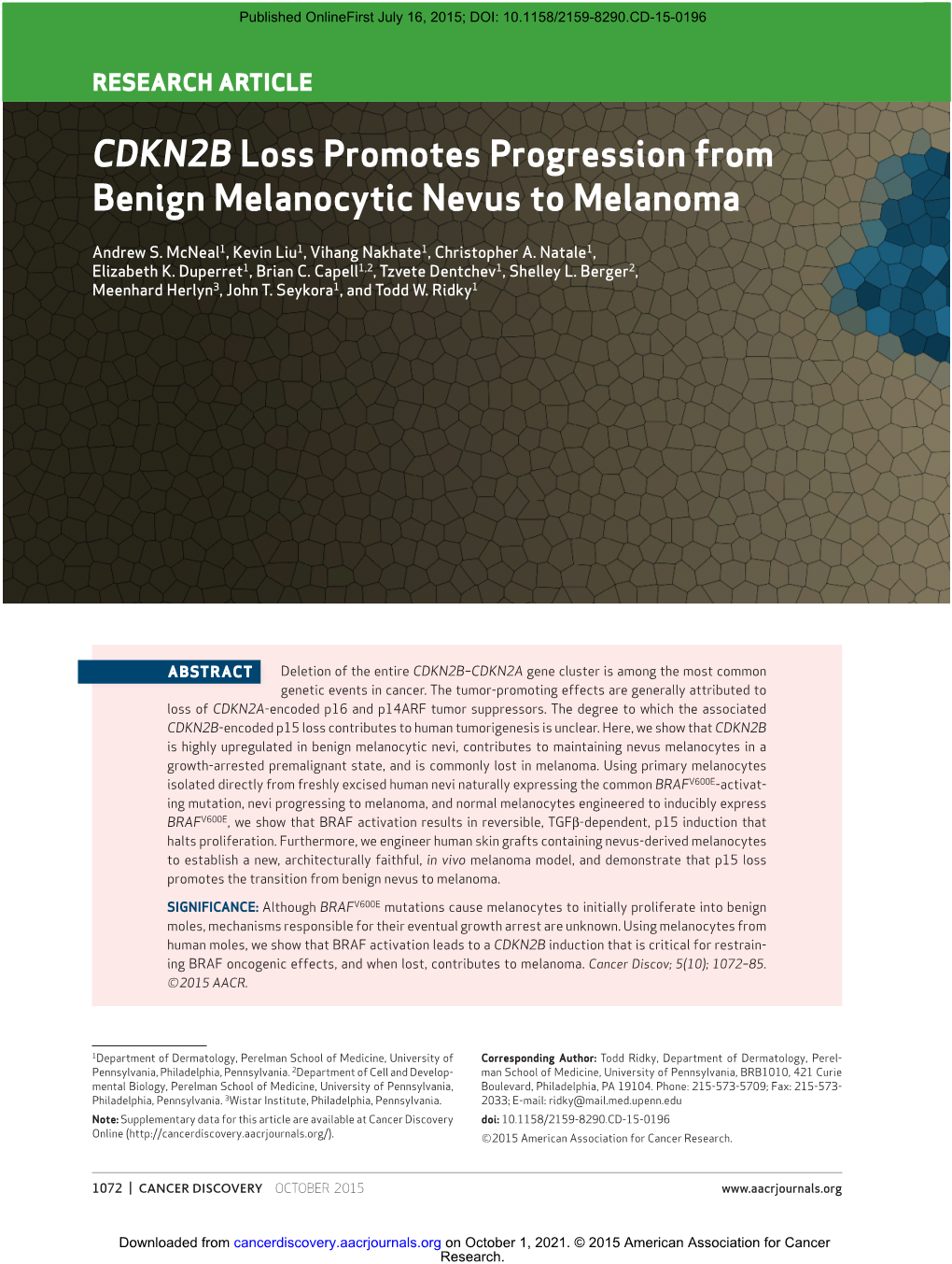 CDKN2B Loss Promotes Progression from Benign Melanocytic Nevus to Melanoma