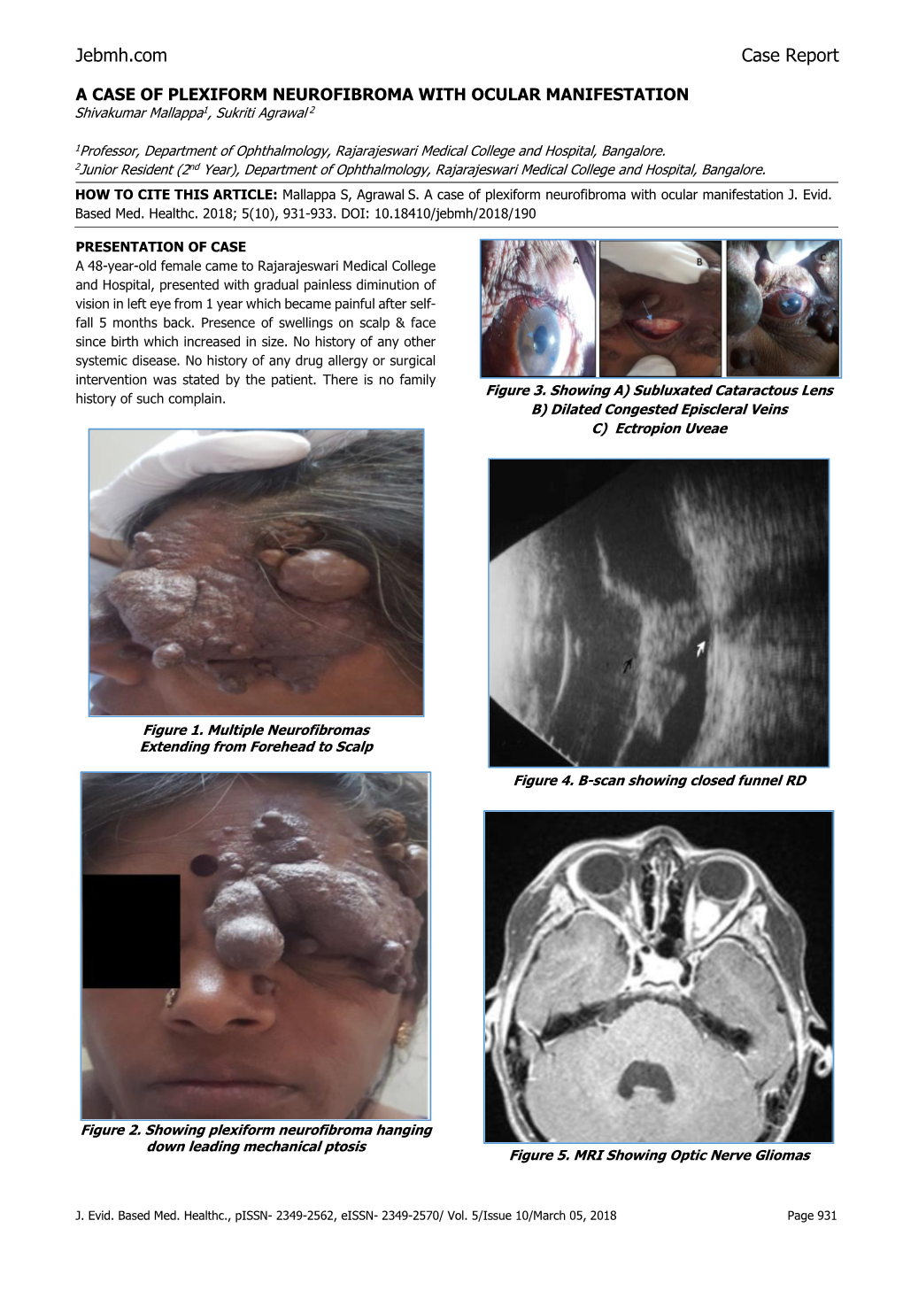 Jebmh.Com Case Report