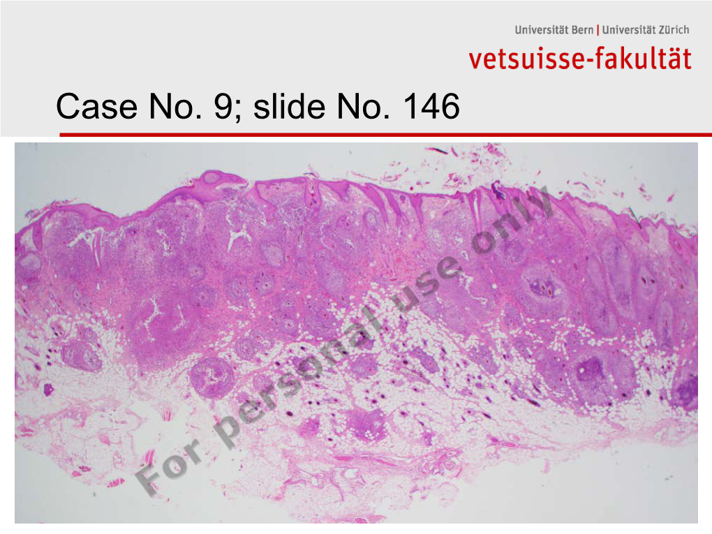 Case No. 9; Slide No. 146