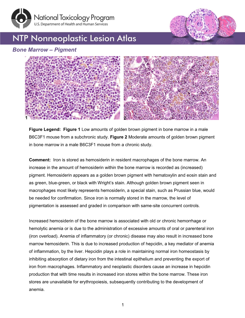 Bone Marrow – Pigment