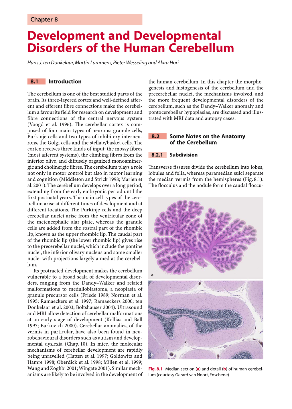 Development and Developmental Disorders of the Human Cerebellum