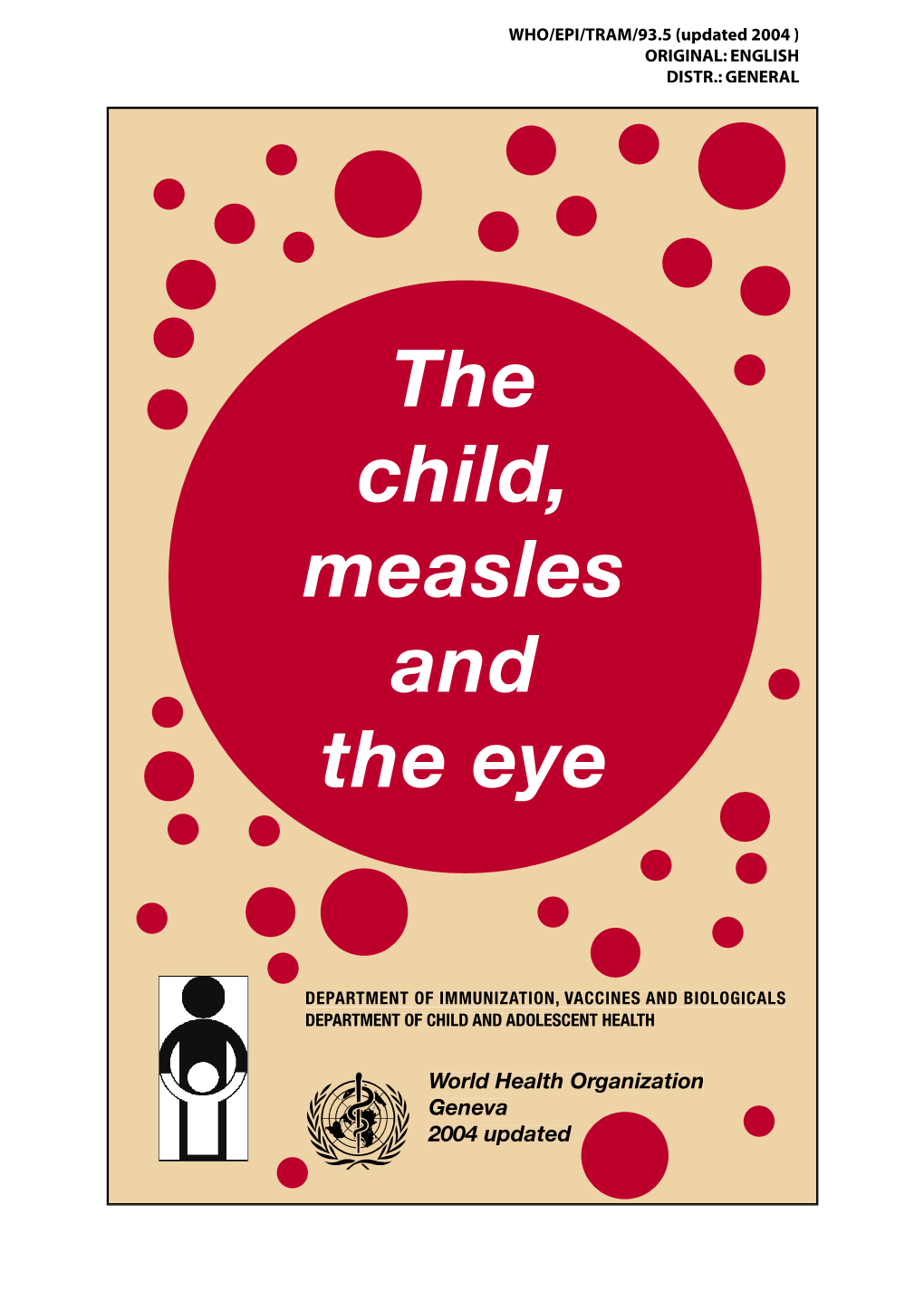 The Child, Measles and the Eye