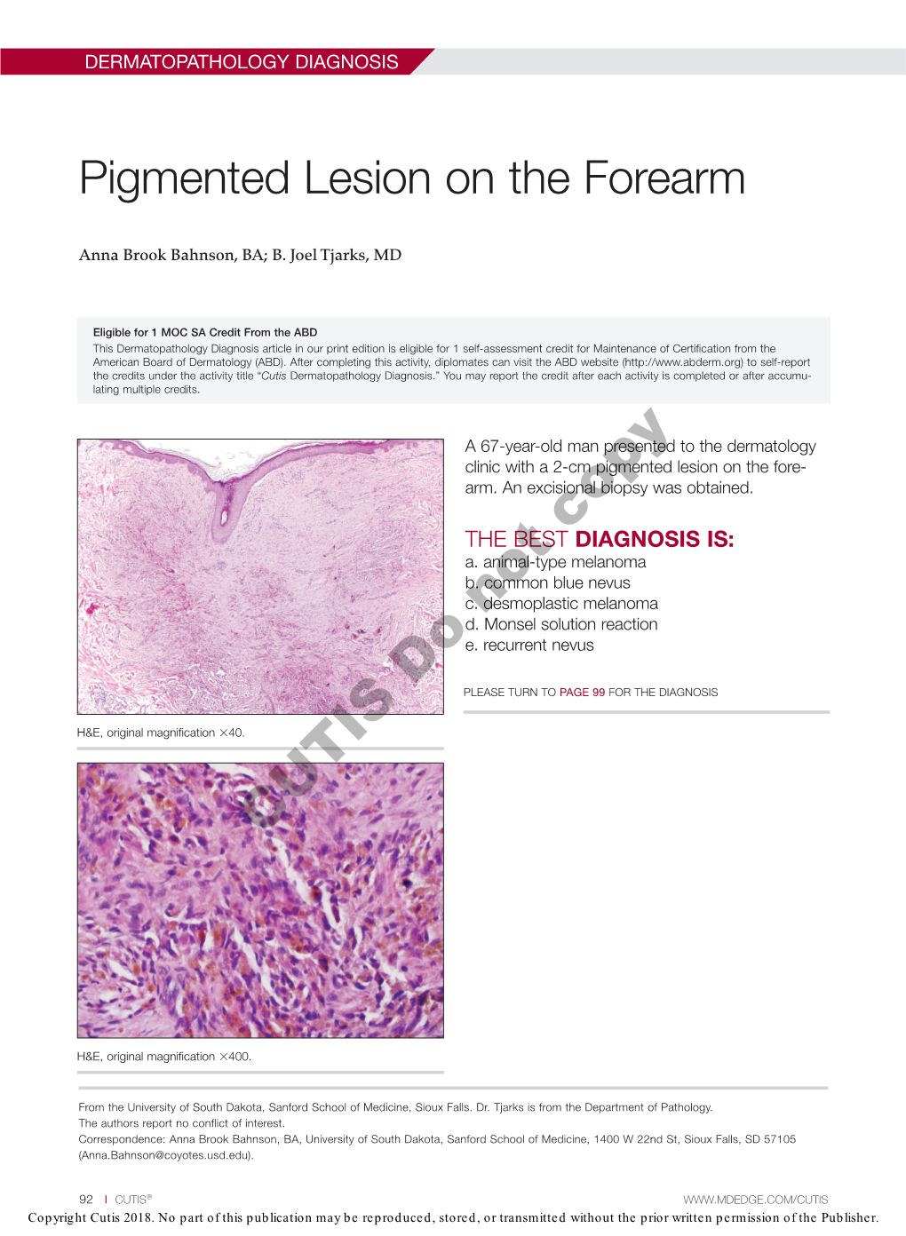 Pigmented Lesion on the Forearm
