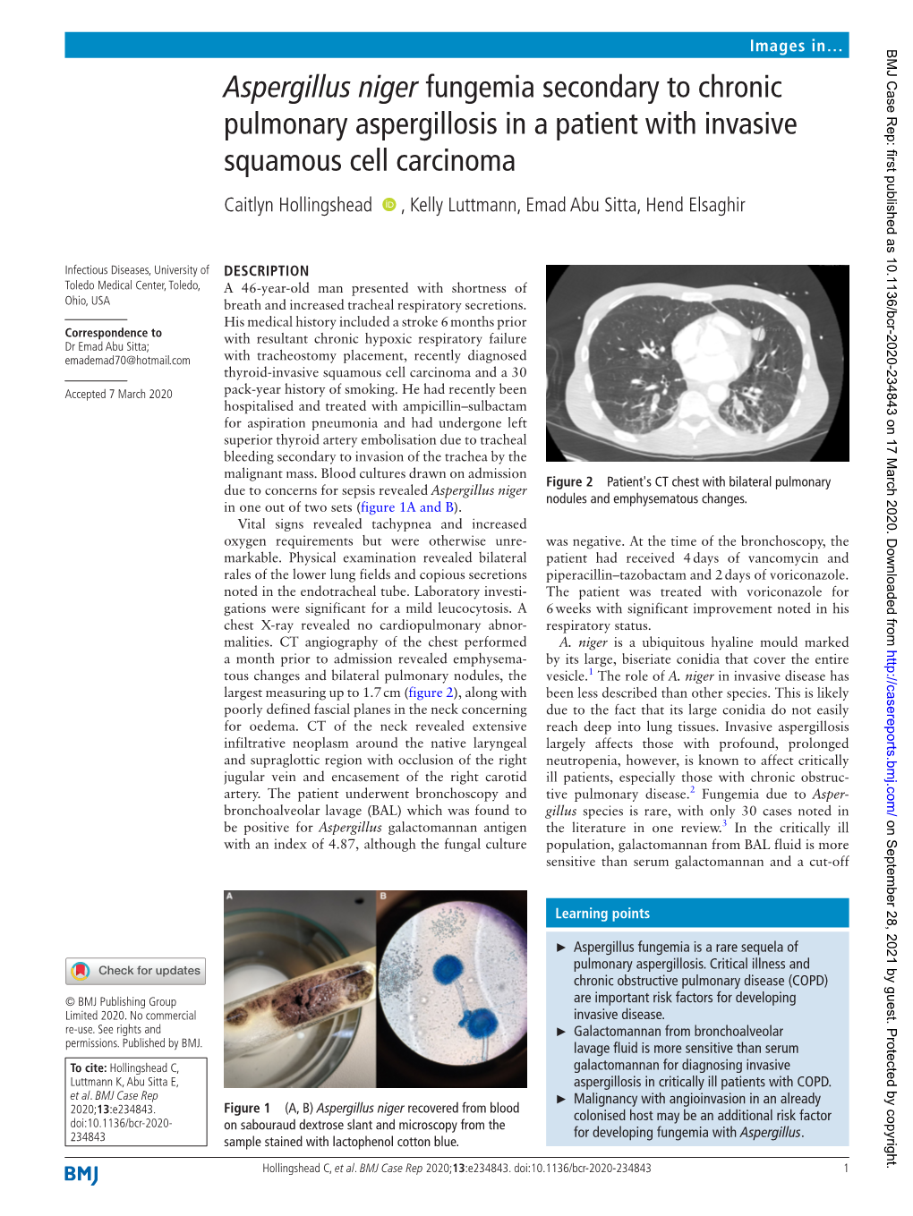 Aspergillus Niger Fungemia Secondary to Chronic Pulmonary Aspergillosis