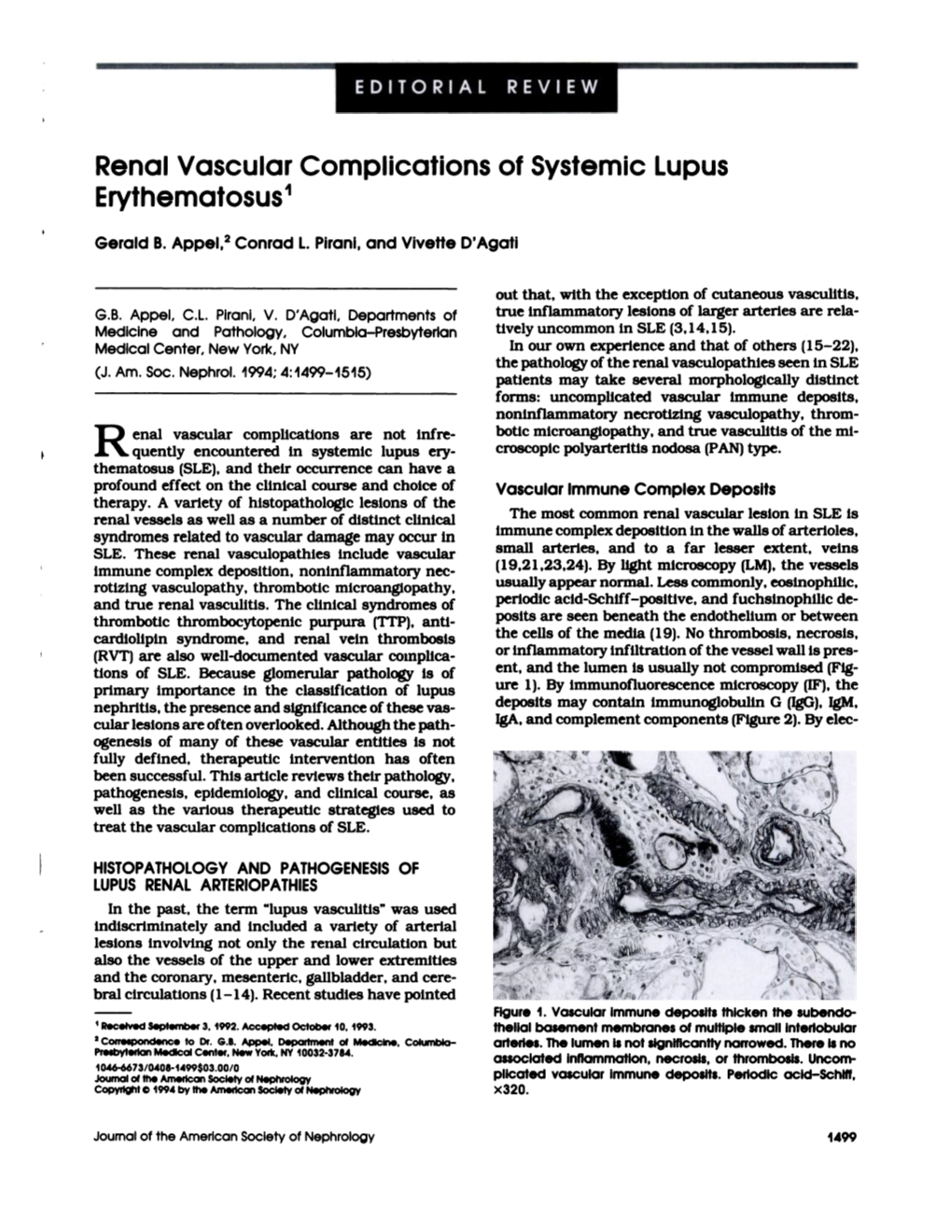 Renal Vascular Complications of Systemic Lupus Erythematosus1