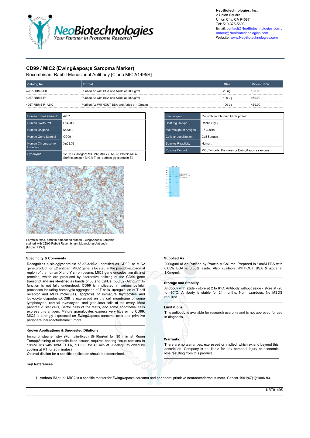 CD99 / MIC2 (Ewing&Apos;S Sarcoma Marker)