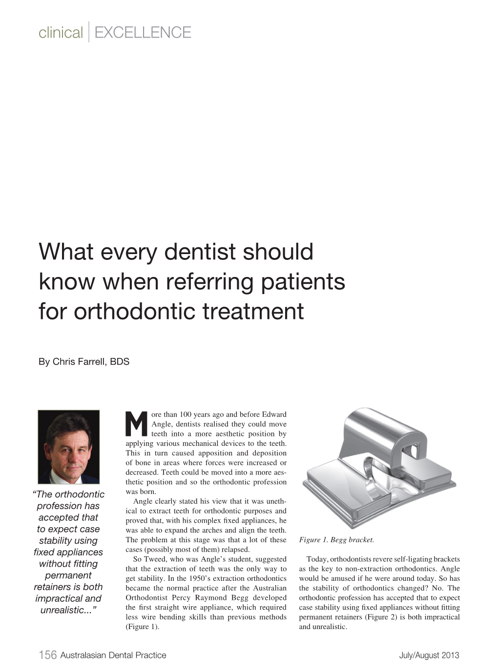 What Every Dentist Should Know When Referring Patients for Orthodontic Treatment