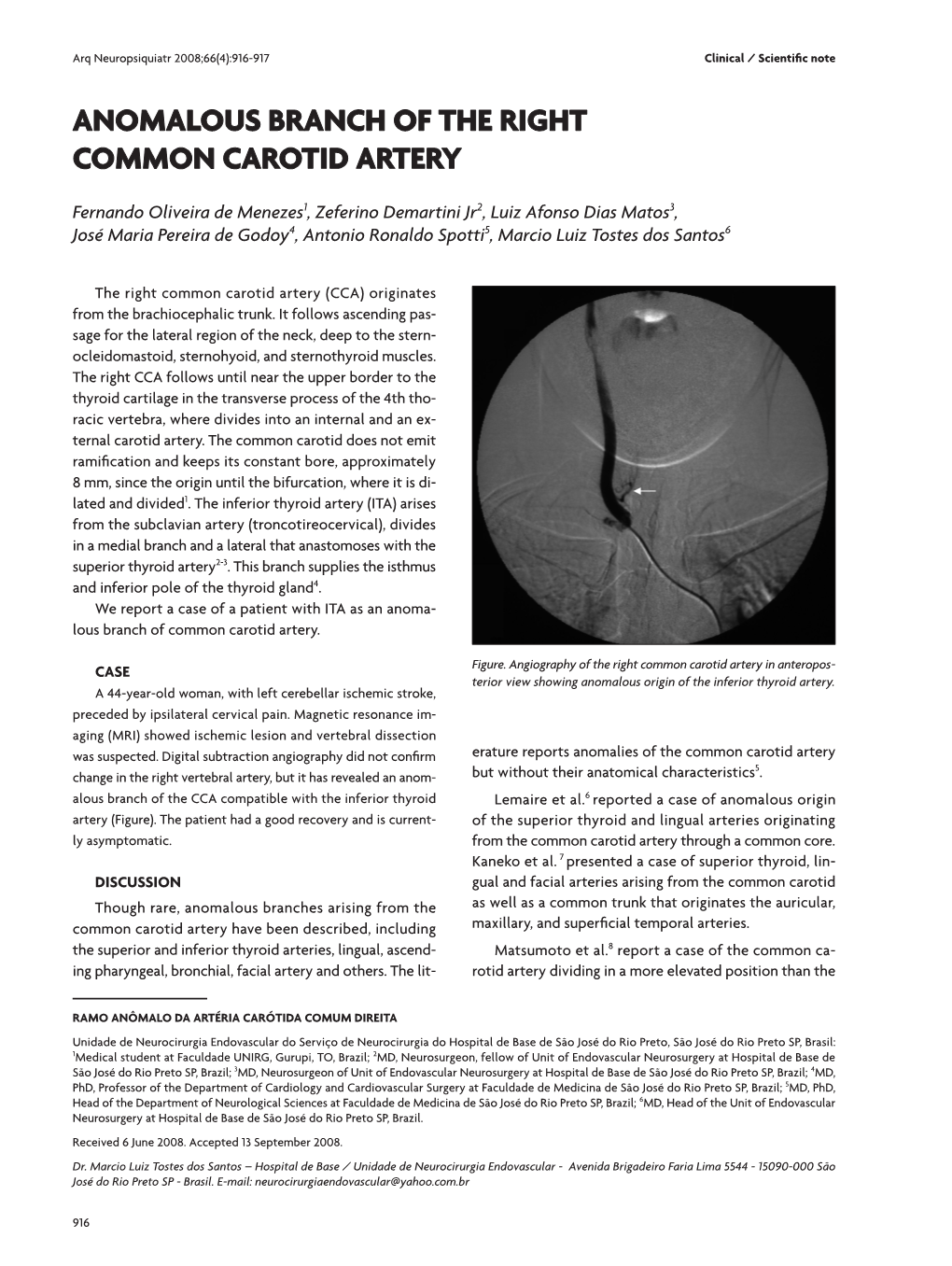 Anomalous Branch of the Right Common Carotid Artery