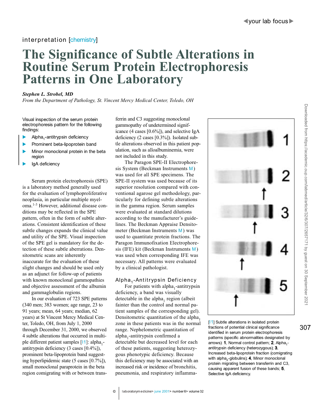 The Significance of Subtle Alterations in Routine Serum Protein Electrophoresis Patterns in One Laboratory