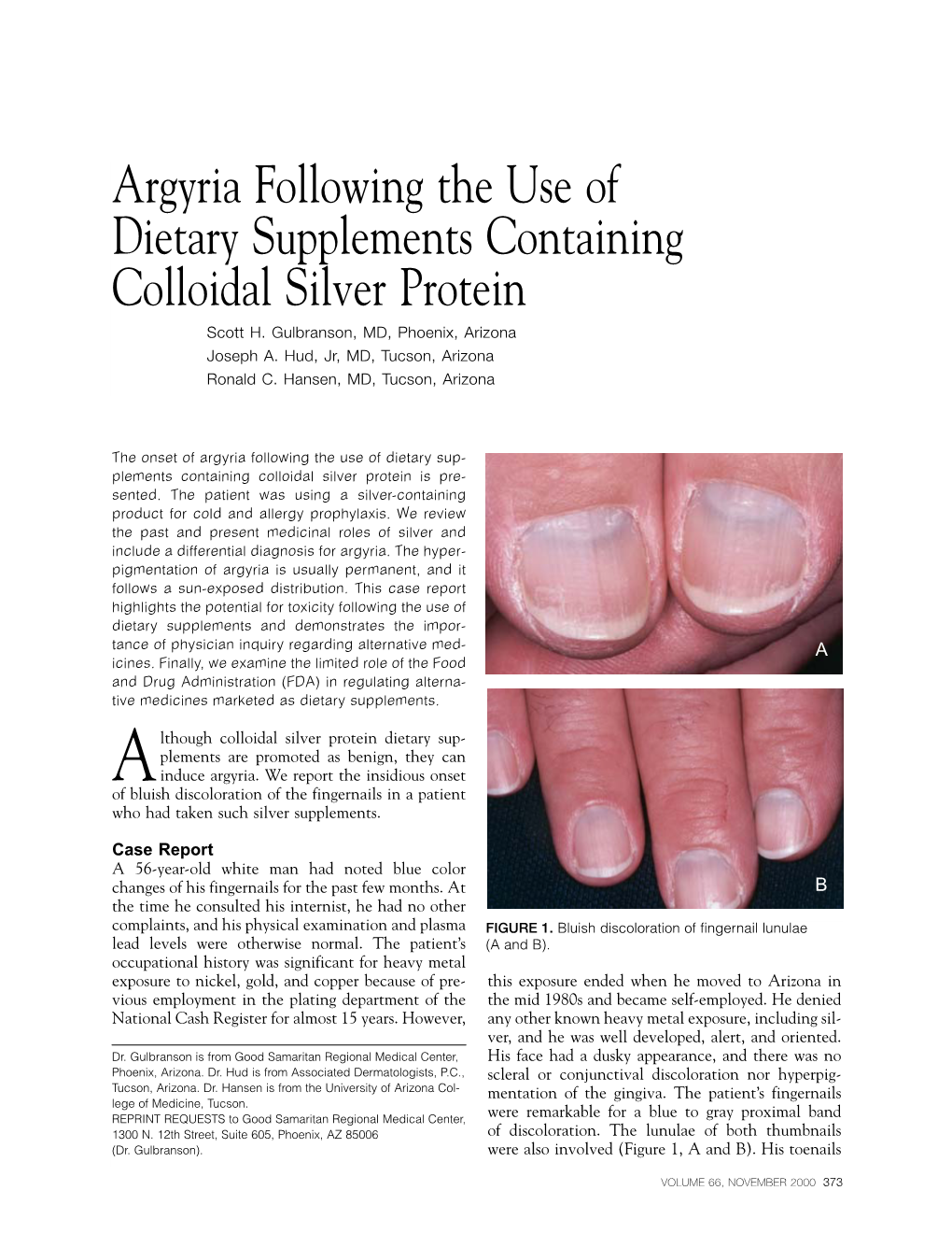 Argyria Following the Use of Dietary Supplements Containing Colloidal Silver Protein Scott H