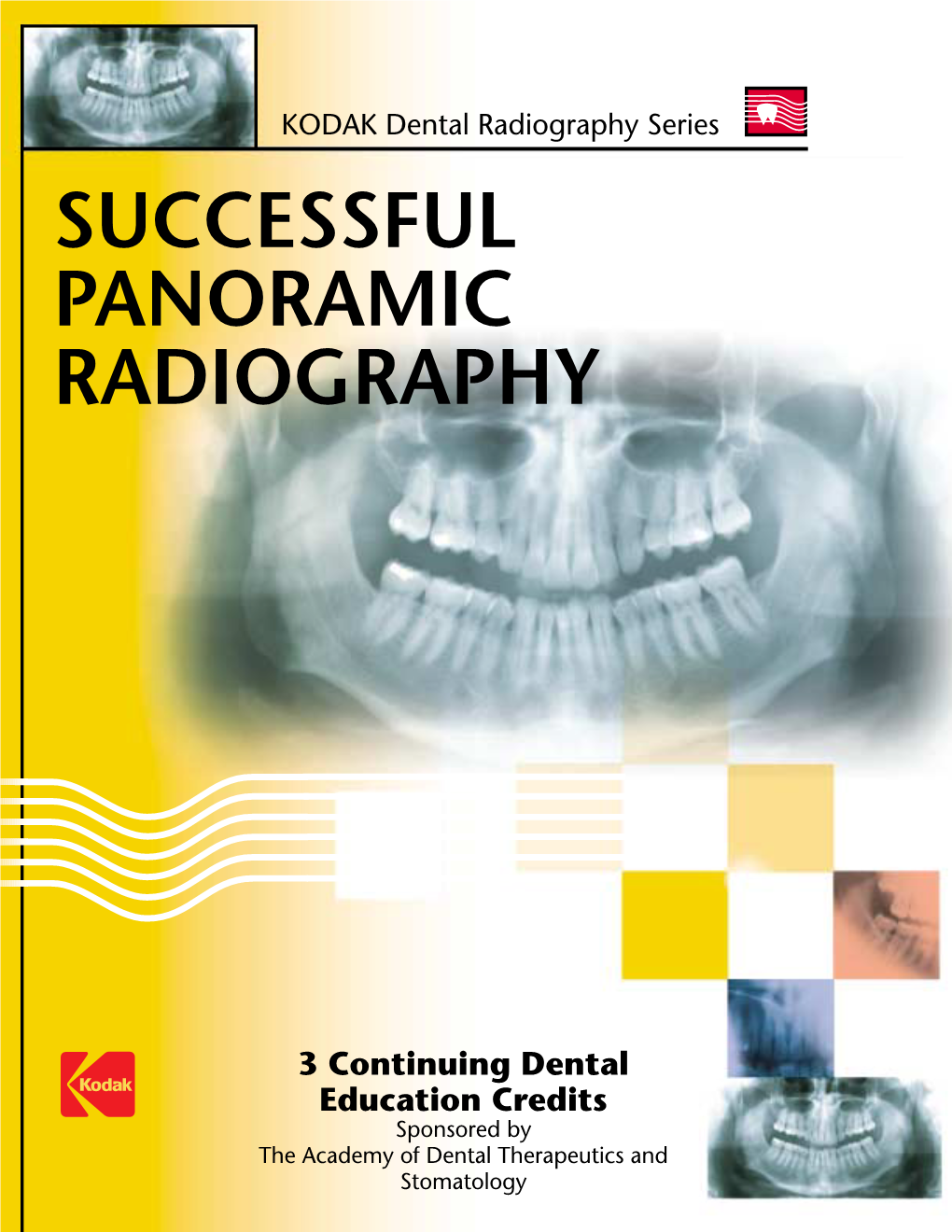 Successful Panoramic Radiography