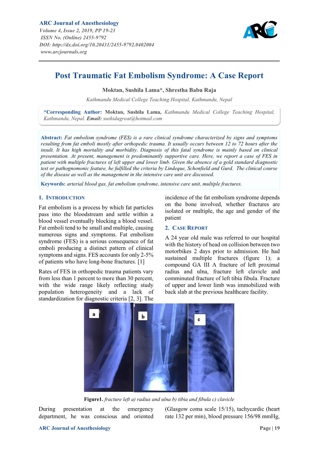 Post Traumatic Fat Embolism Syndrome: a Case Report