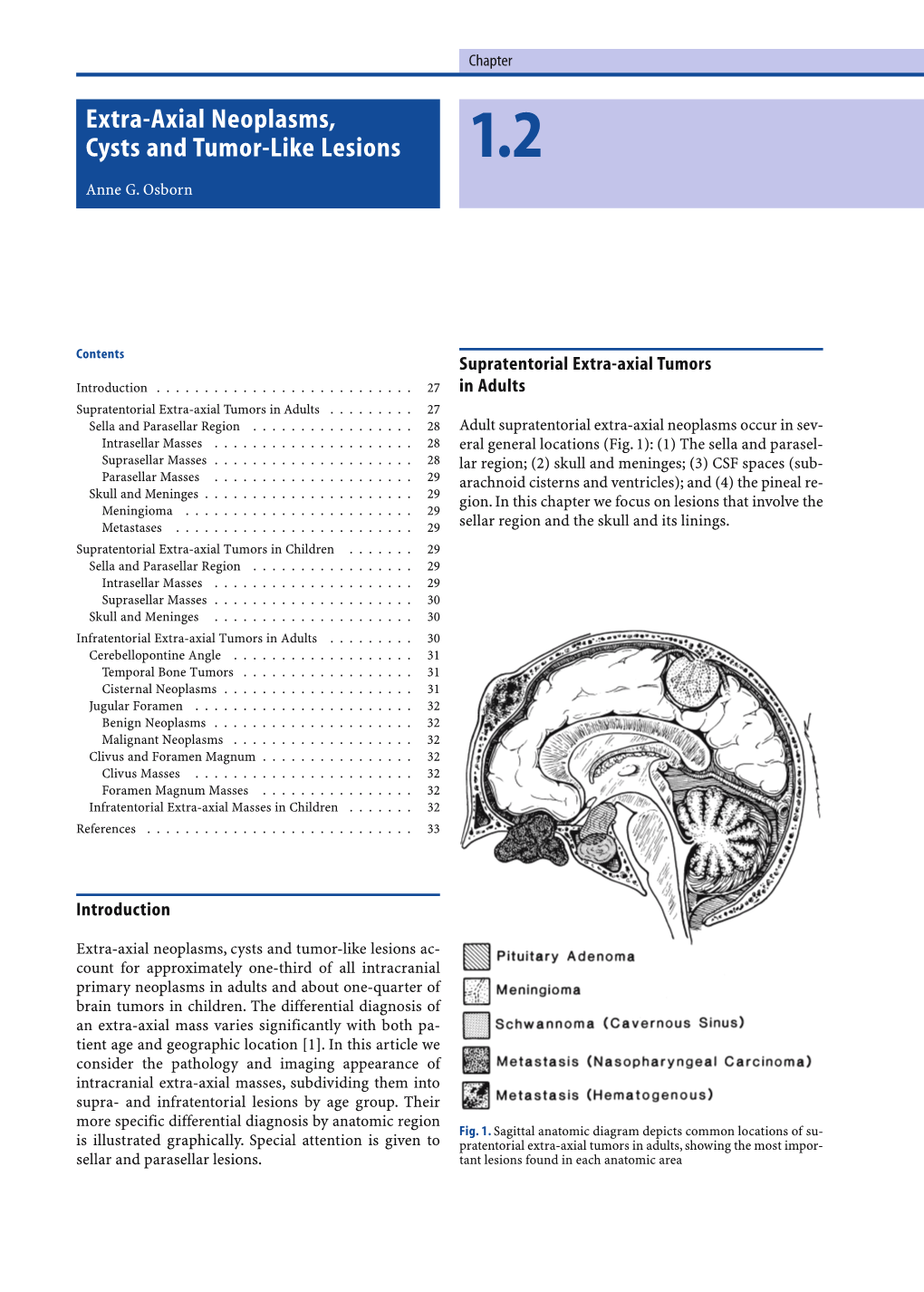 Extra-Axial Neoplasms, Cysts and Tumor-Like Lesions 1.2 Anne G