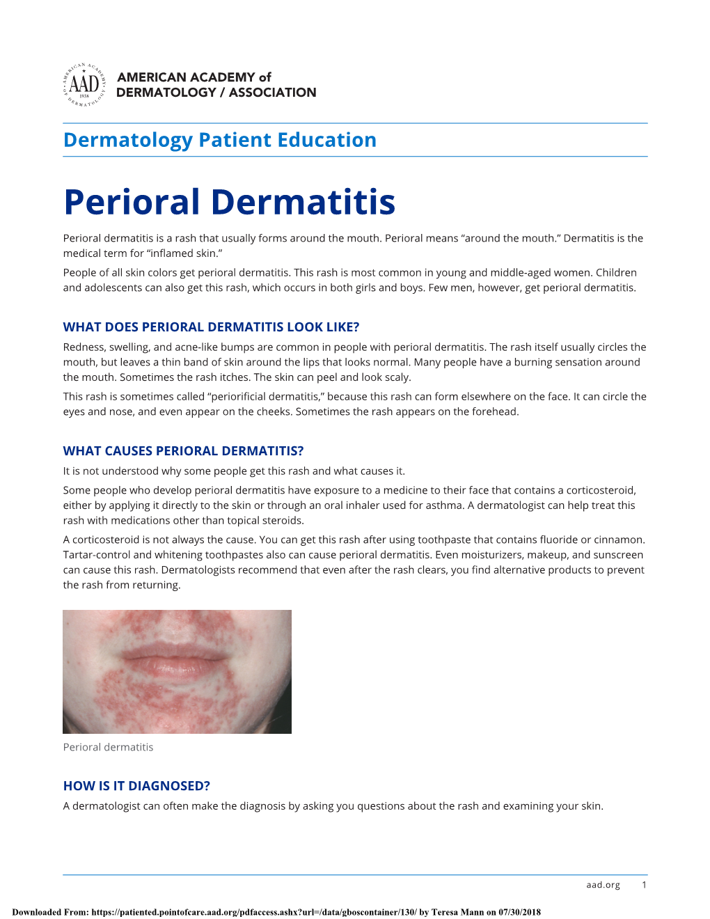 Perioral Dermatitis Perioral Dermatitis Is a Rash That Usually Forms Around the Mouth