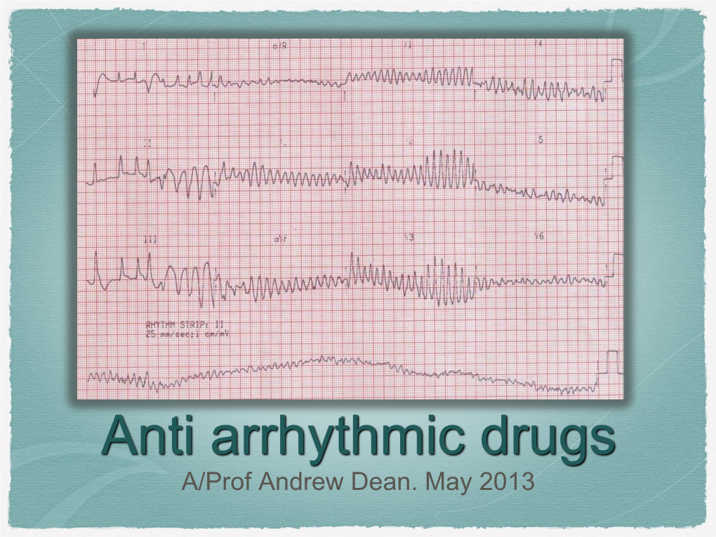 Anti Arrhythmic Drugs A/Prof Andrew Dean