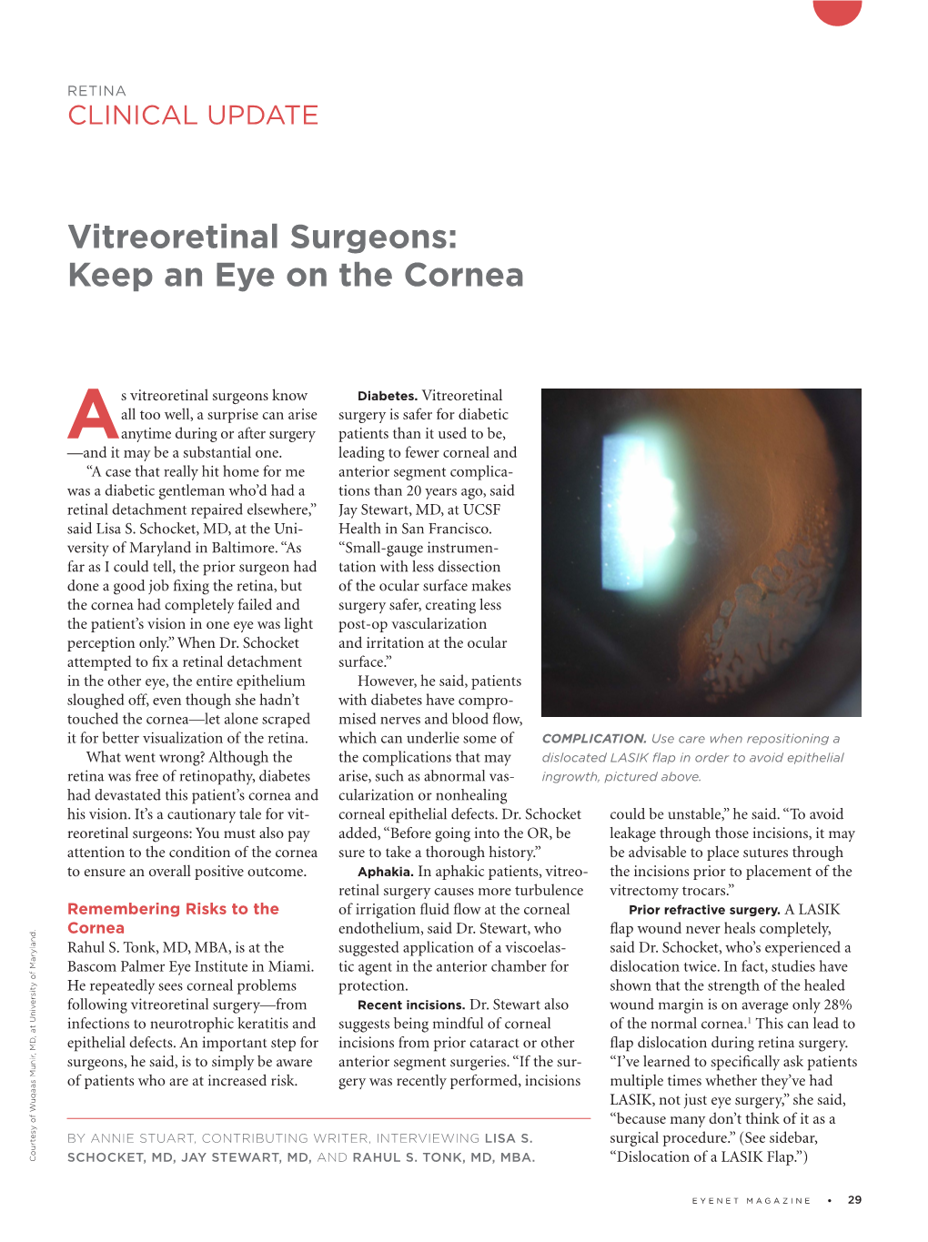 Vitreoretinal Surgeons: Keep an Eye on the Cornea