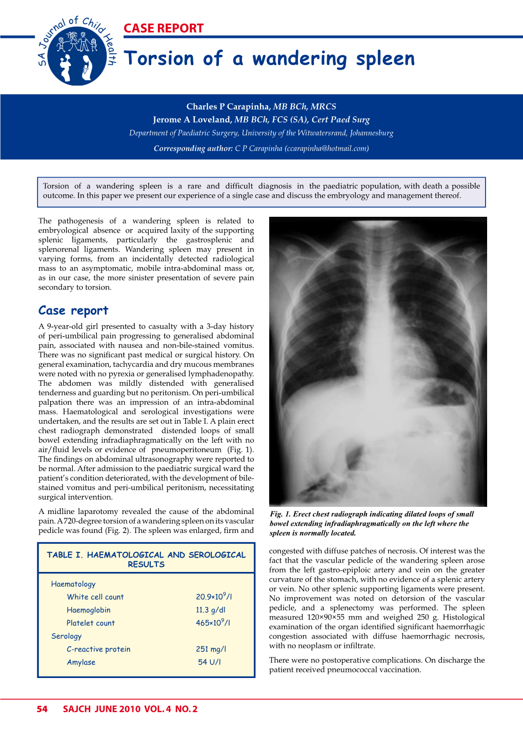 Torsion of a Wandering Spleen