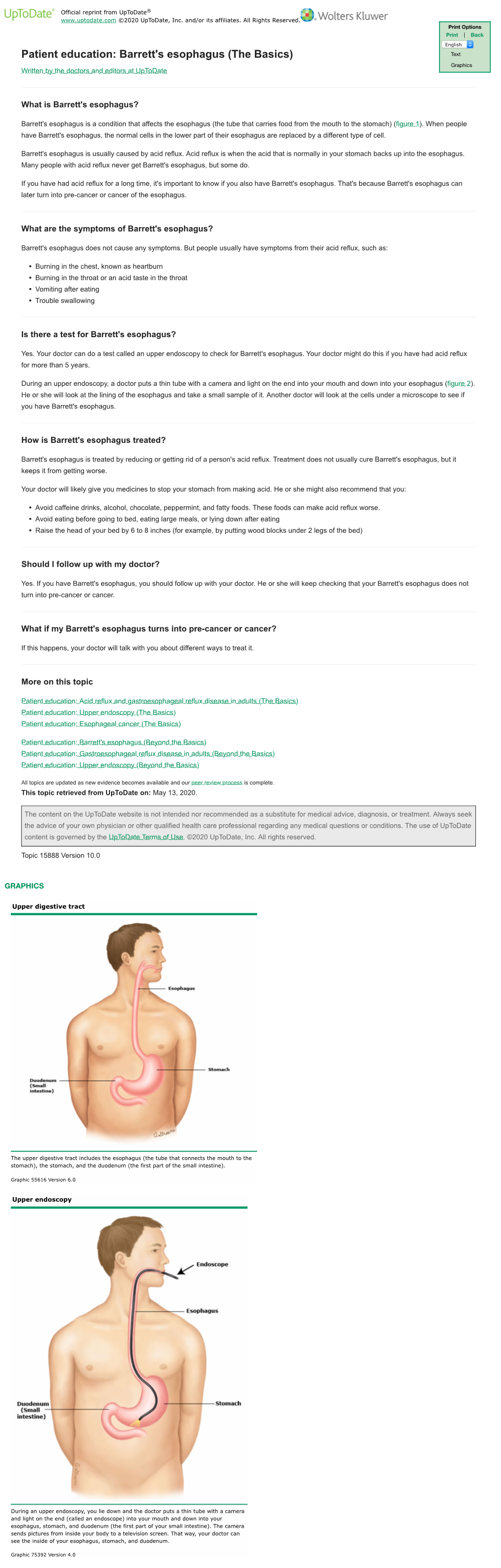 Barrett's Esophagus (The Basics) Text Graphics Written by the Doctors and Editors at Uptodate