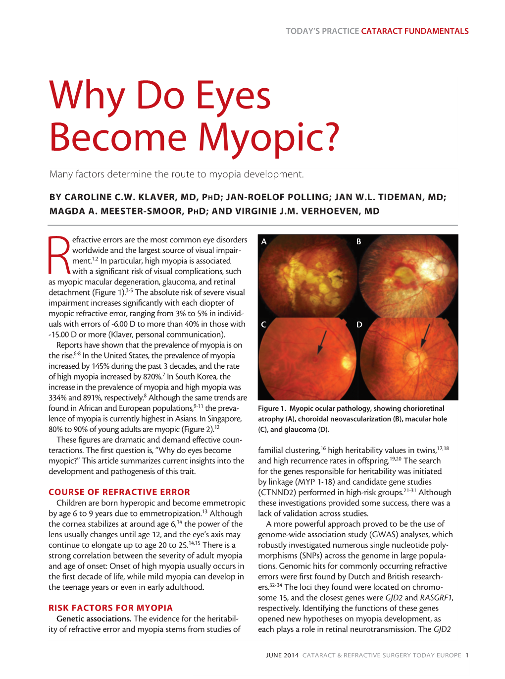 Why Do Eyes Become Myopic? Many Factors Determine the Route to Myopia Development