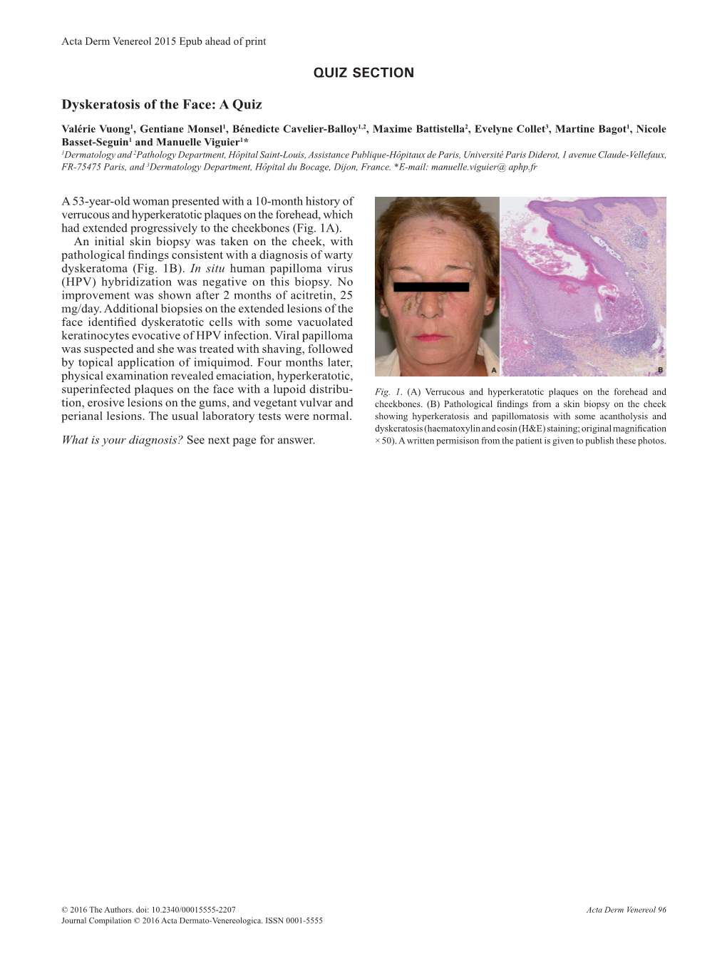 QUIZ SECTION Dyskeratosis of the Face