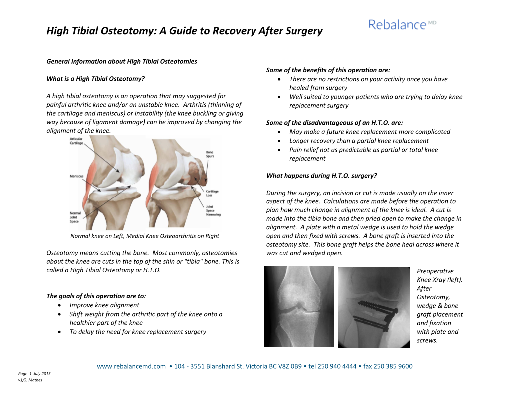 High Tibial Osteotomy: a Guide to Recovery After Surgery